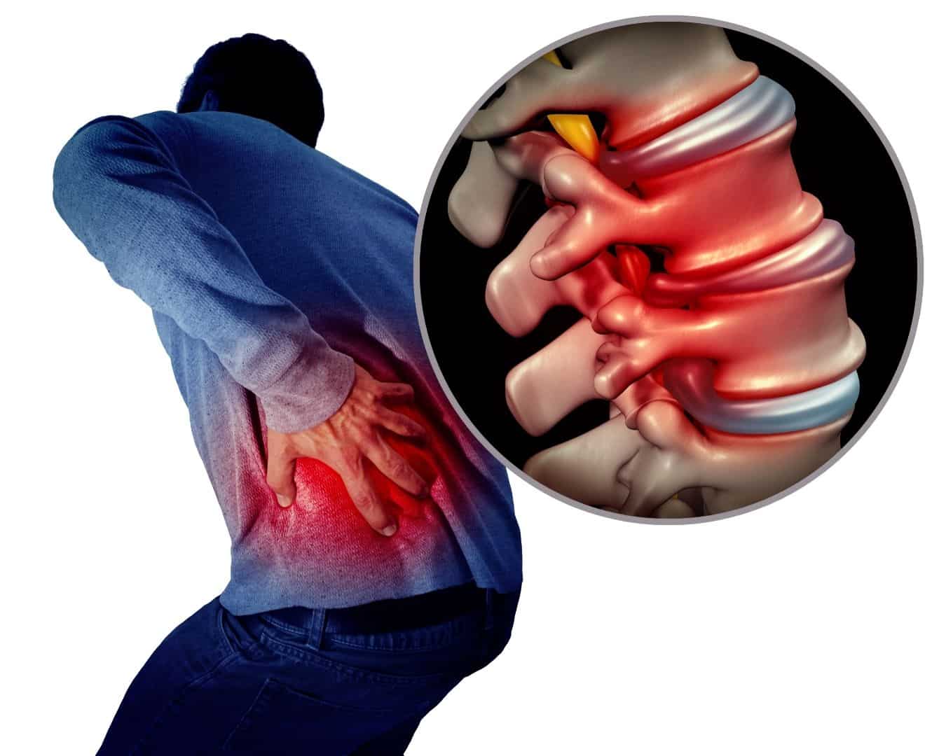 https://pttimewithtim.com/wp-content/uploads/2021/06/Lumbar-Spinal-Stenosis-Exercises.jpg