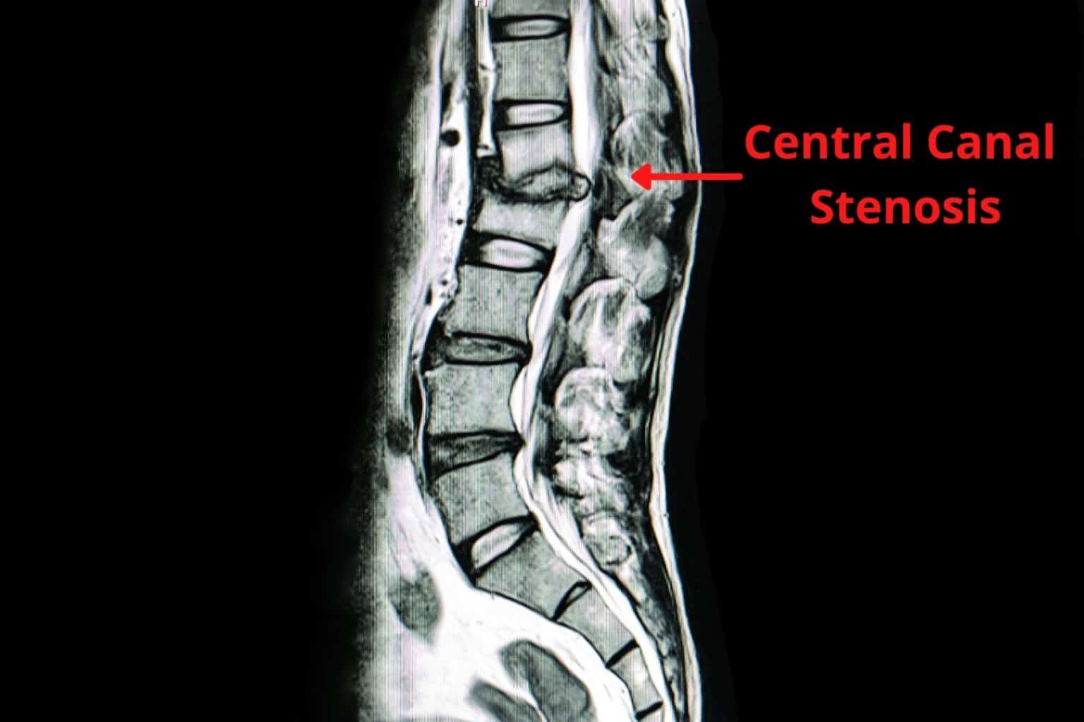 Why Does My Back Hurt? 10 Common Causes of Low Back Pain | PT Time with Tim